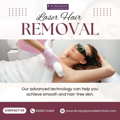 Dr Naiya Bansal - Laser Hair Removal In Chandigarh ( Free )