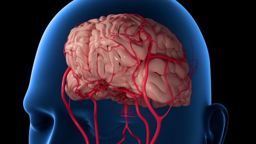 Coiling For Brain Aneurysm | Minimally Invasive ( Free )