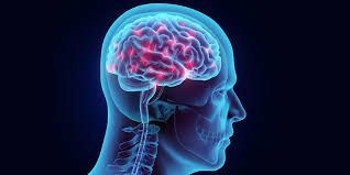 Brain Hemorrhage Treatment With Advanced Interventional Radiology ( W